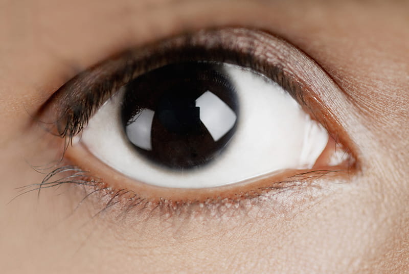 OPHThalmology